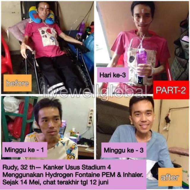 Botol hydrogen fontain