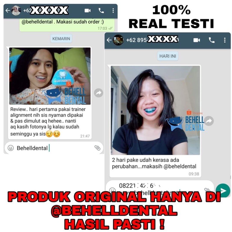 PERAPIH GIGI BEHELLDENTAL ORIGINAL / ALAT PELURUS TANPA BEHEL / TEETH TRAINER RETAINER ALIGNMENT 100% ORI ASLI - Dental Perata Gigi