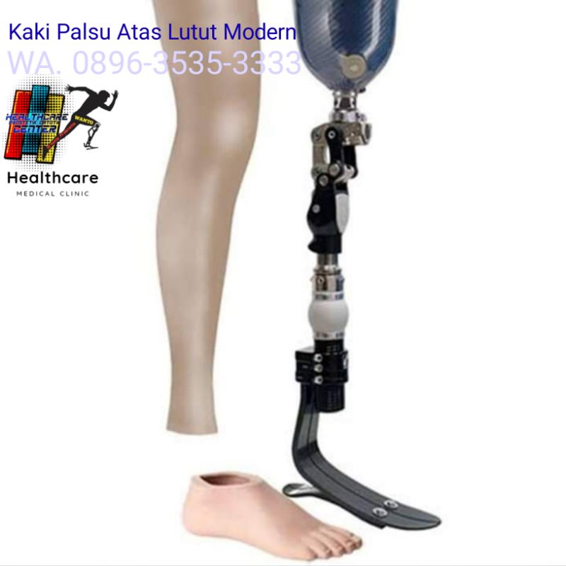 Kaki Palsu Atas Lutut Modern