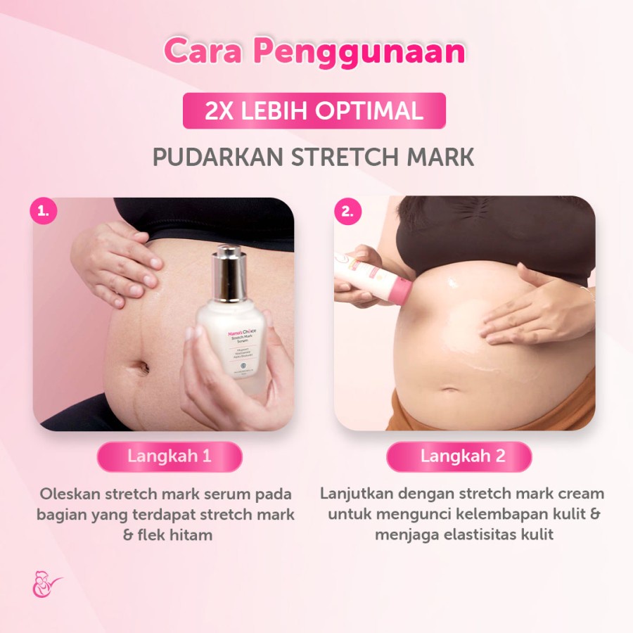 Mama's Choice Stretch Mark Cream | Krim Penghilang Selulit Guratan