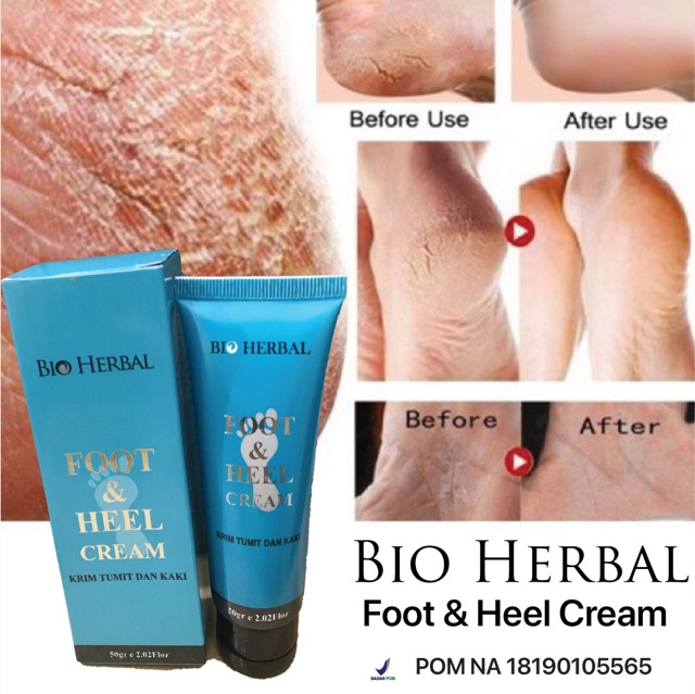 Bio Herbal Foot and Heel Cream