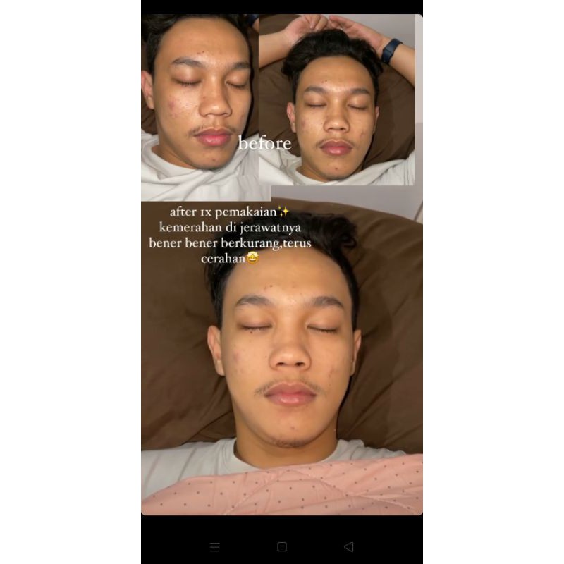 ❗READY❗ [RESELLER RESMI✅] Camille Beauty mask  BPOM✅|Camille Beauty-8