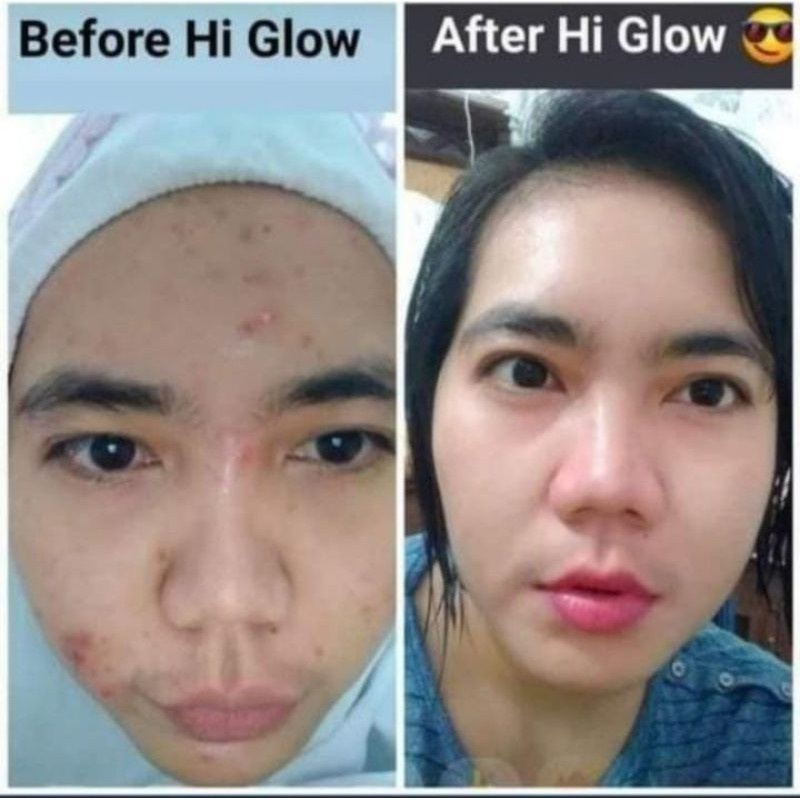 HIGLOW ULTIMATE SKINCARE ORIGINAL BPOM