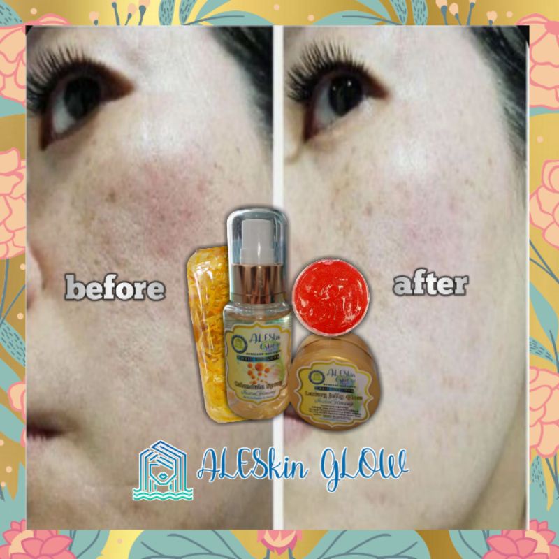 LUXURY ARBUTIN JELLY ALESKIN GLOW Skincare Glowing-Paket Perawatan Wajah Korea-Cream Glowing