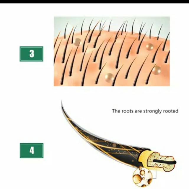 Cairan Essence Penumbuh Rambut Anti Rontok-3