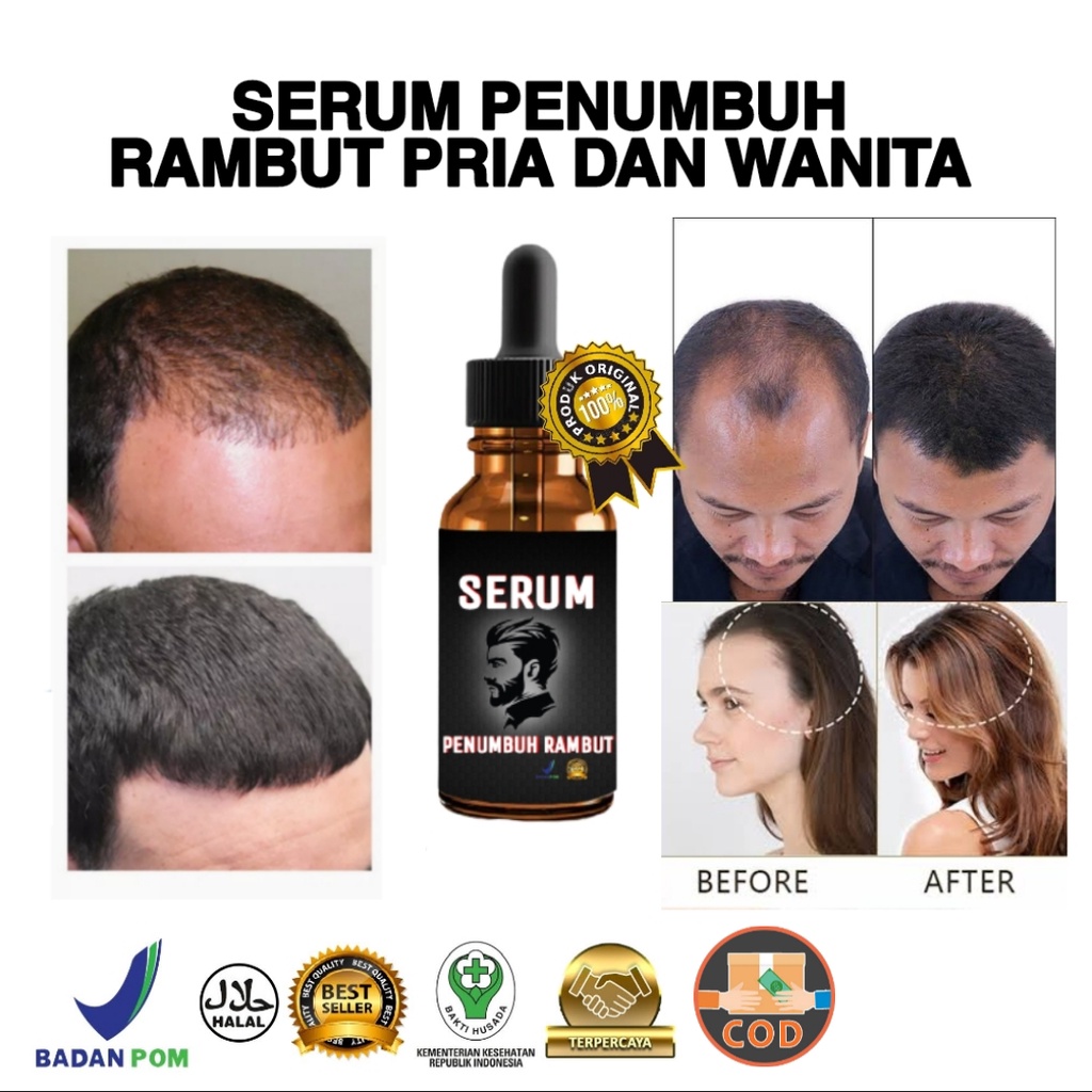 Serum Rambut Penumbuh Rambut / Serum penumbuh rambut secara cepat penumbuh rambut botak / penumbuh r