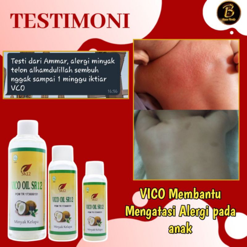 

VICO OIl 250ML