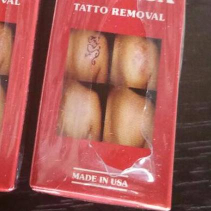 Tatonox Penghilang Tato