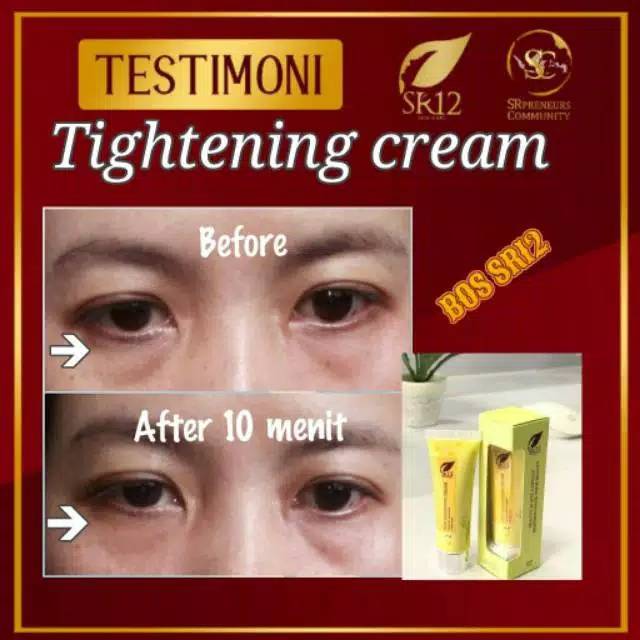 TIGHTENING CREAM SR12 / WHITENING TERBAIK / PENCERAH WAJAH / PENGENCANG ANTI KERUT WAJAH / HERBAL TIGHTENING CREAM SR12 / Krim hilangkan kerutan dalam 10 menit  Skin Tightening krim sr12