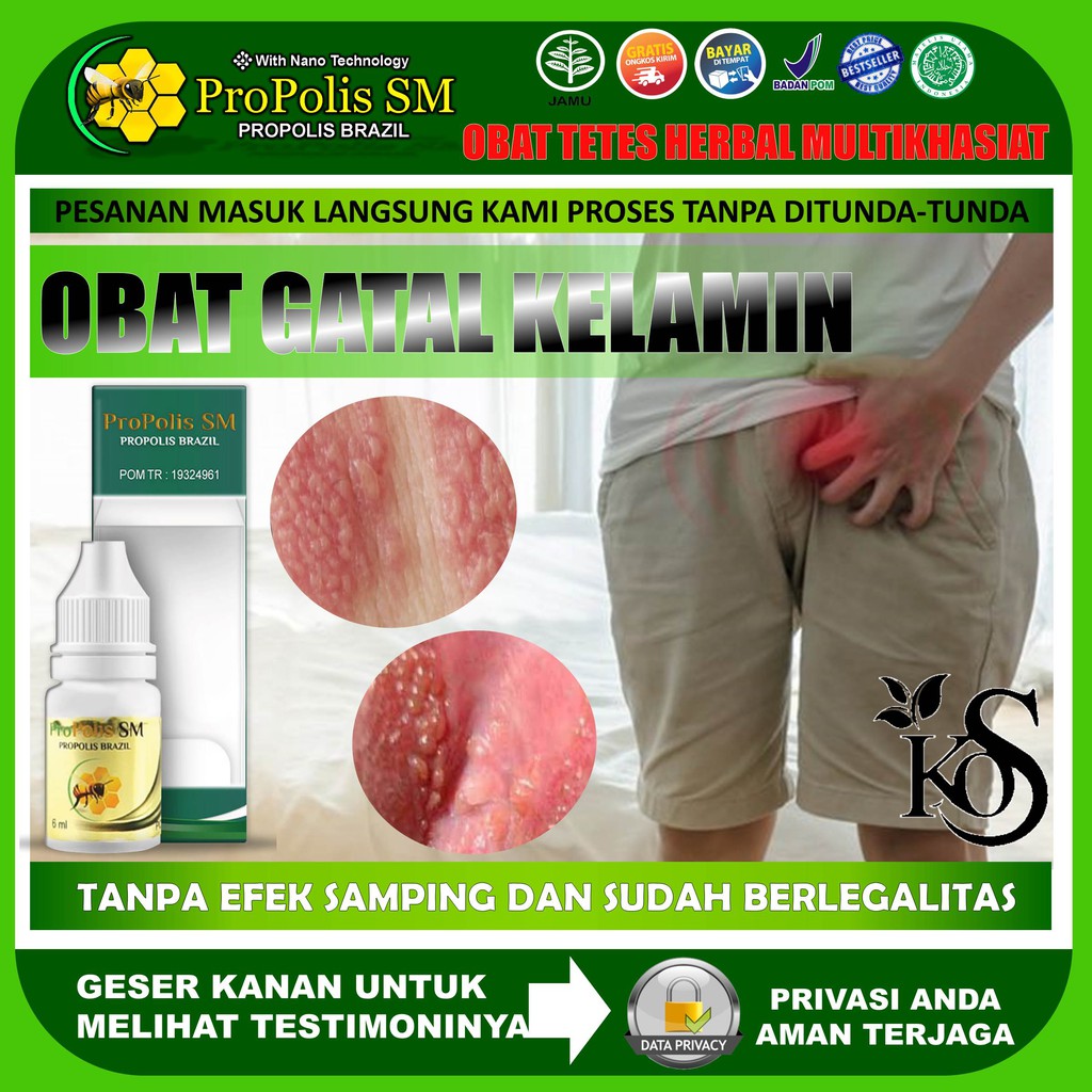 Propolis SM Brazil Obat Gatal Di Area Kelamin Obat Gatal Penis Obat Herbal Gatal Mr P Obat Herbal Ga