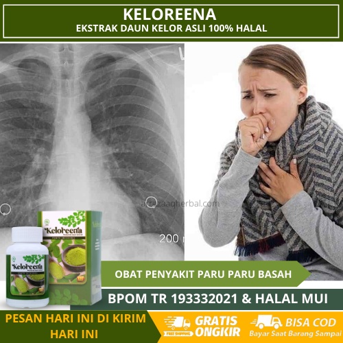 Obat Paru Paru Basah, Paru Paru Kering, Penyakit Kanker Paru Paru, Flek Paru-Paru, Pembersih Cairan 