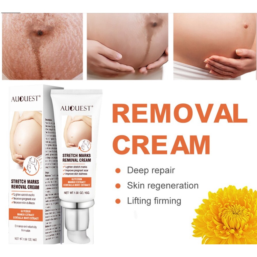 AUQUEST 45g Cream Kurangi Strech Mark saat Hamil & Usai Melahirkan