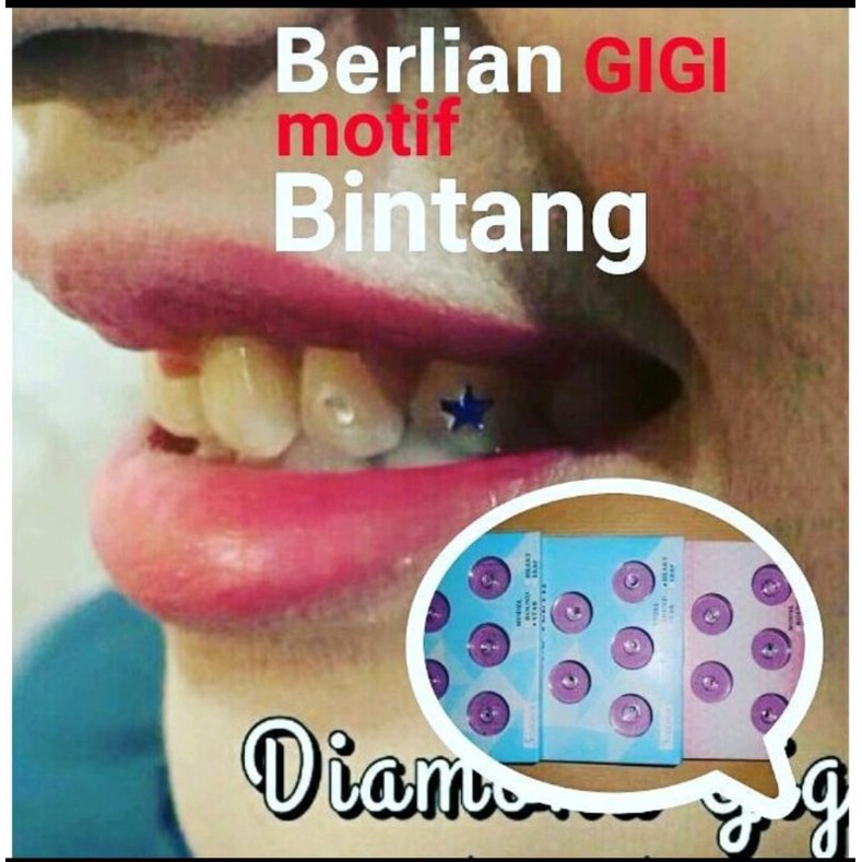 berlian gigi bintang