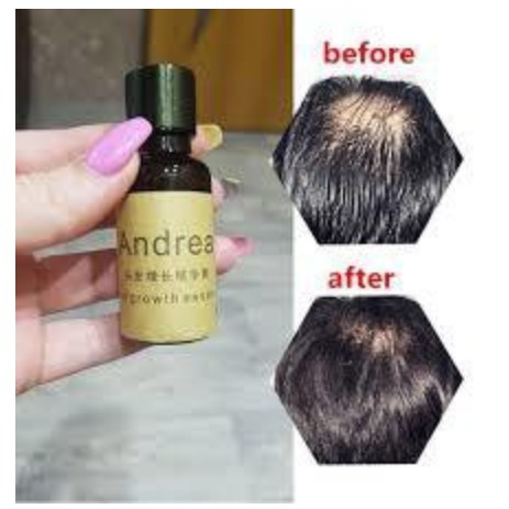 SERUM RAMBUT ANDREA GLOWTH HAIR ASSENCE EFEKTIF MENGATASI RAMBUT RONTOK TIPIS BOTAK TOP ORIGINAL