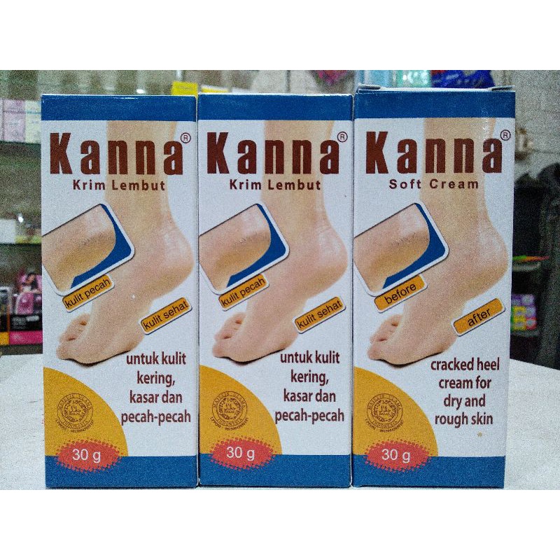 Kanna Krim Lembut 30g