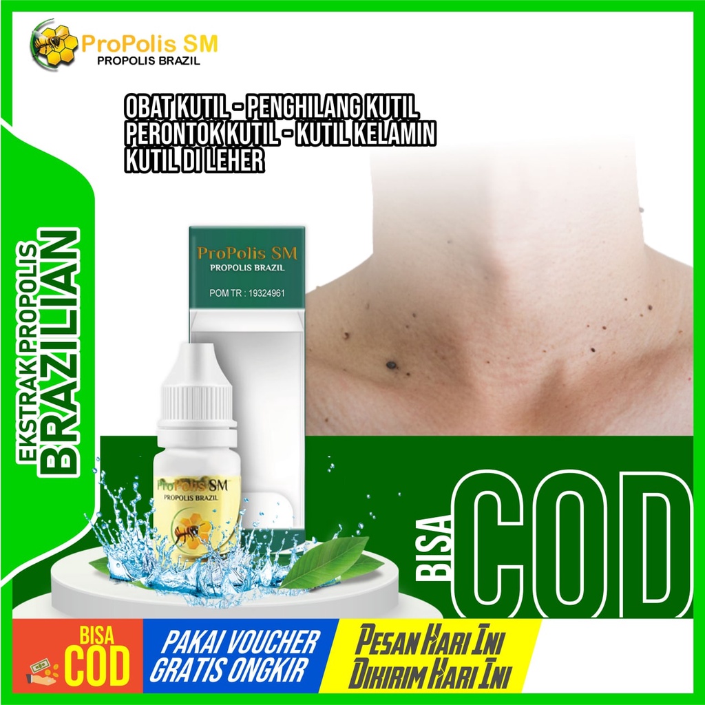 Obat Kutil - Penghilang Kutil - Perontok Kutil - Papiloma - Kutil Di Leher - Kutil Di Tangan - PROPO