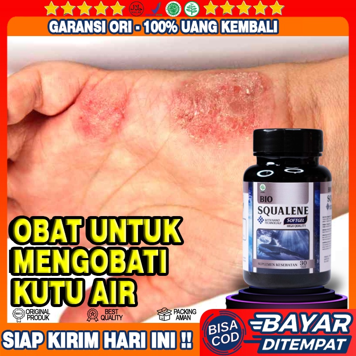 Obat Kutu Air Tangan - Obat Penghilang Kutu Air - Obat Gatal Kaki - Obat Jamur Kaki - Obat Kutu Air 