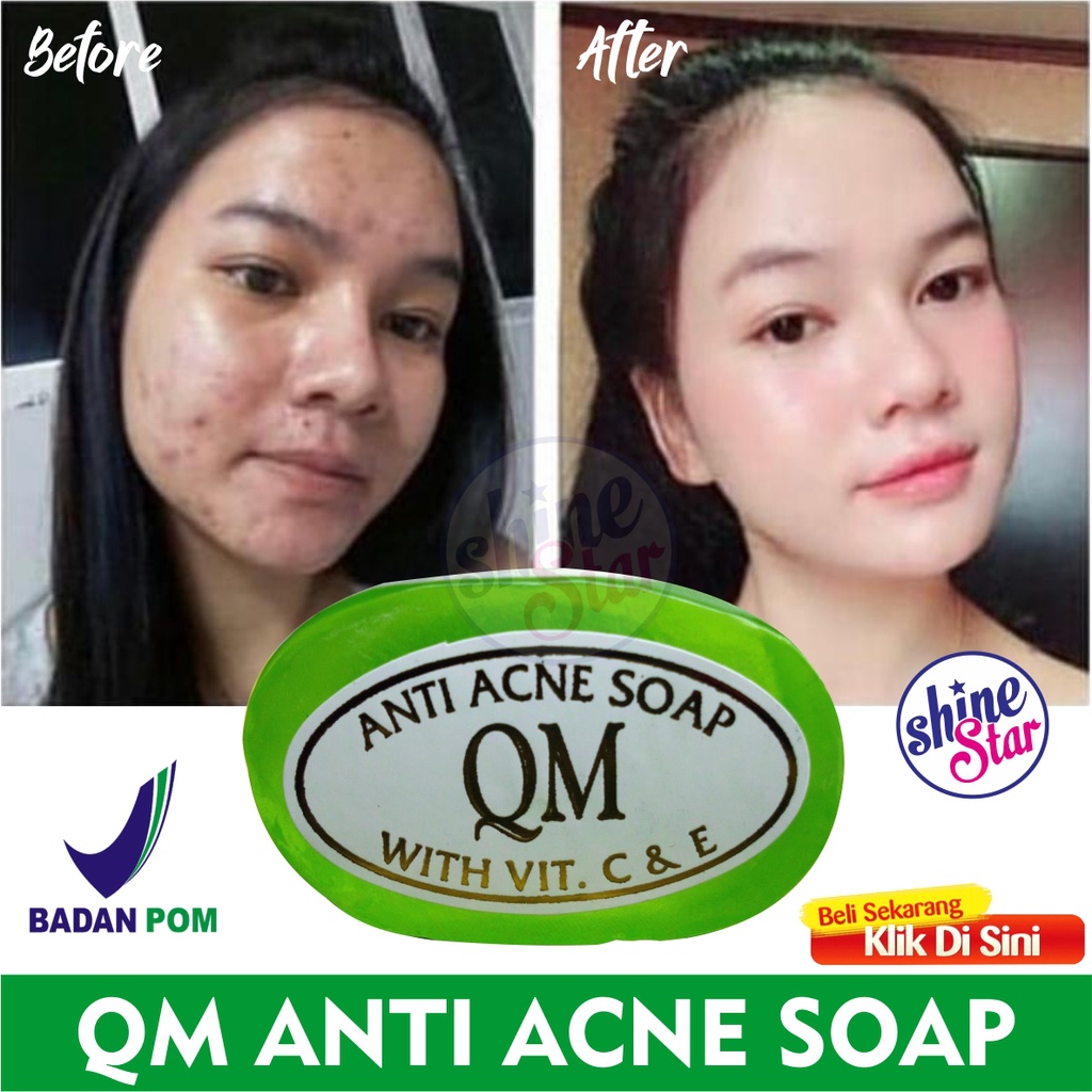 SHINE STAR - ORIGINAL 100% BPOM Sabun QM Anti Acne -Sabun Ampuh Menghilangkan Jerawat dan Bekas Jerawat /Flek