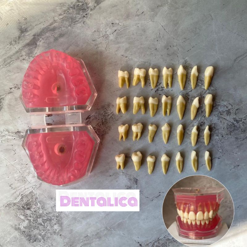 Dental phantom gigi tiruan/ model study replika gigi lepasan lepas pasang