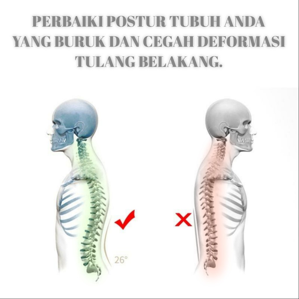 Terapi Tulang Punggung Pinggang Back Stretcher - Magic Back Massager