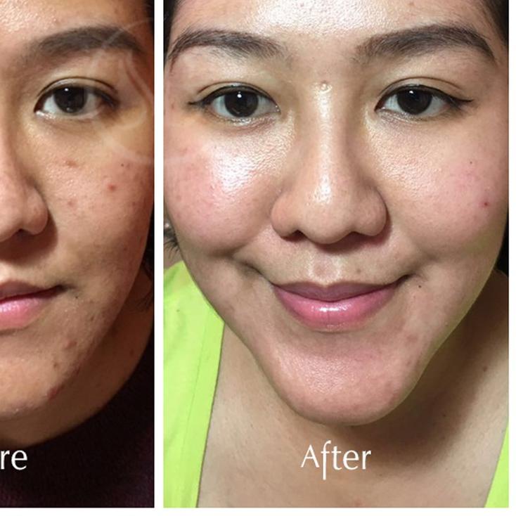 SHANIKA BEAUTY 1 PAKET WHITENING | PAKET PUTIH DALAM 7 HARI ✨ | Tanpa Pouch