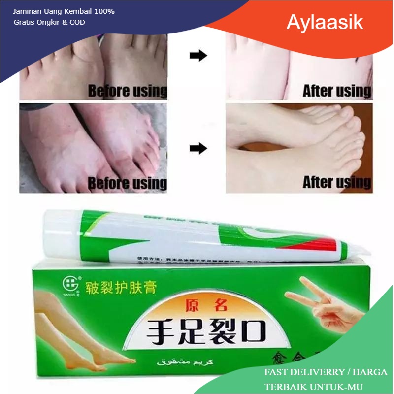 Kemasan Terbaru !!! Krim Kulit kaki pecah-pecah Obat Cream Salep Tumit Kaki Kering, Tebal dan Pecah&quot; AMPUH 100%