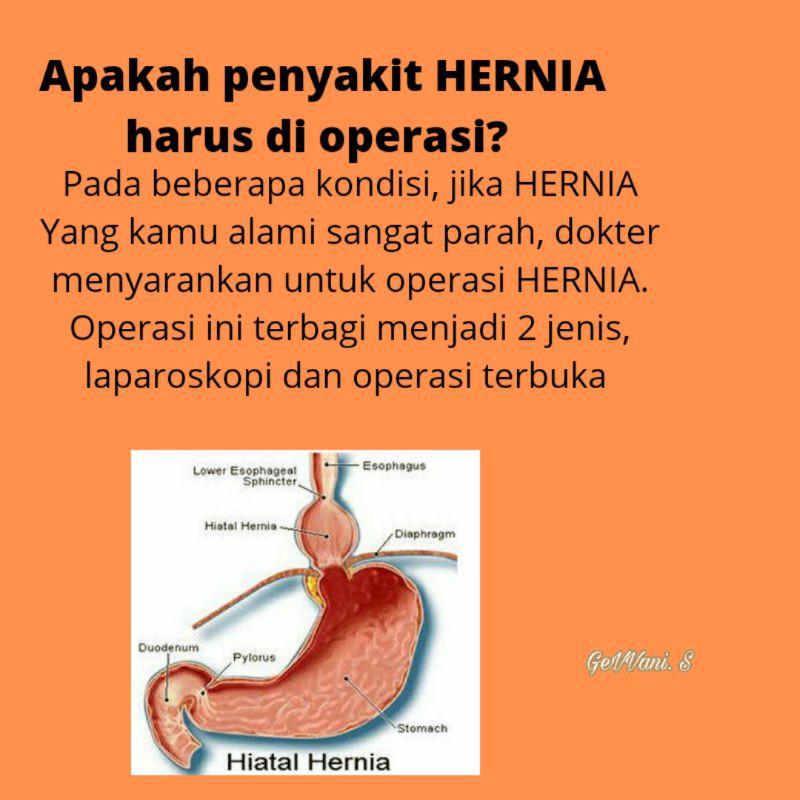 Celana Hernia Cowo Laki laki  Anak Dewasa Murah Berkualitas