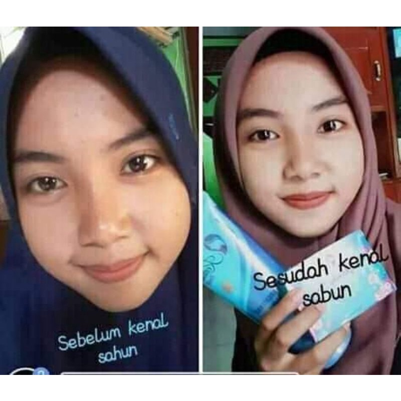 [ORIGINAL] KEDAS BEAUTY BRIGHTENING SOAP, SABUN PEMUTIH WAJAH, SABUN PENCERAH WAJAH, 100g-4