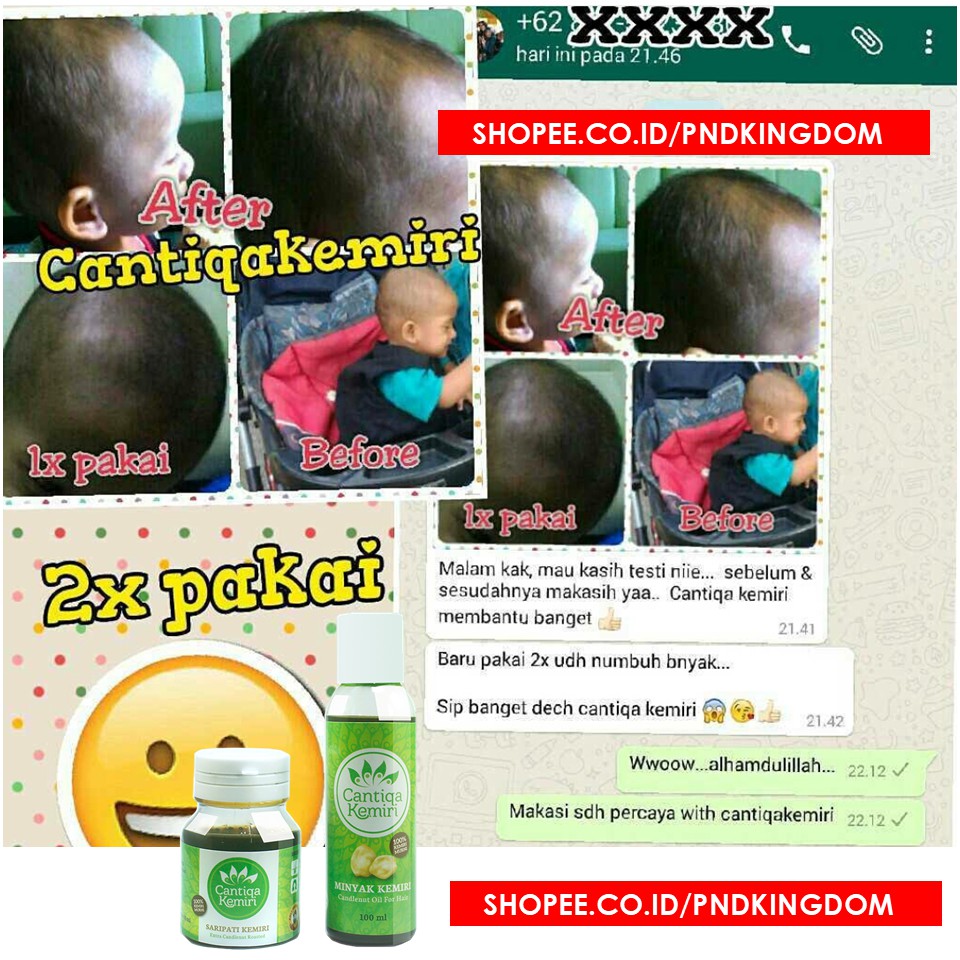 PAKET CANTIQA KEMIRI Penumbuh Rambut Botak Pitak Nonong Herbal Alami