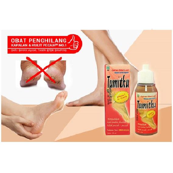 [ORI!] Obat Kapalan Pecah kulit TUMITKU