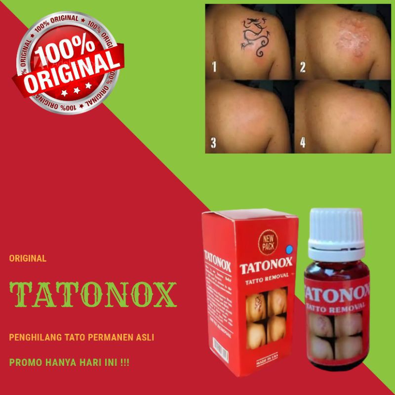 TATONOX ASLI / PENGHILANG TATO PERMANEN / PENGHILANG TATO