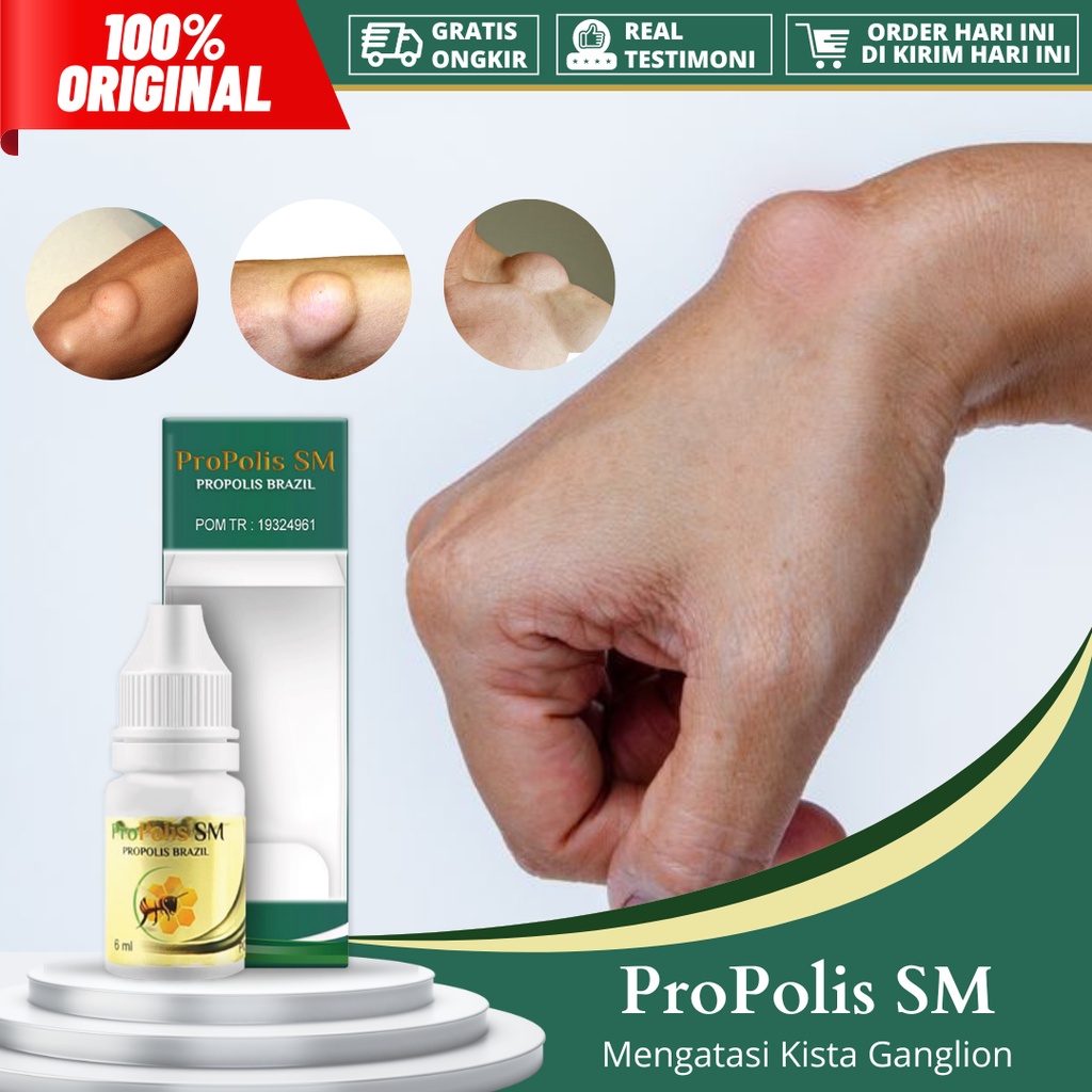 Jual Obat Papiloma Di Apotik Harga Terbaik & Termurah Februari 2023