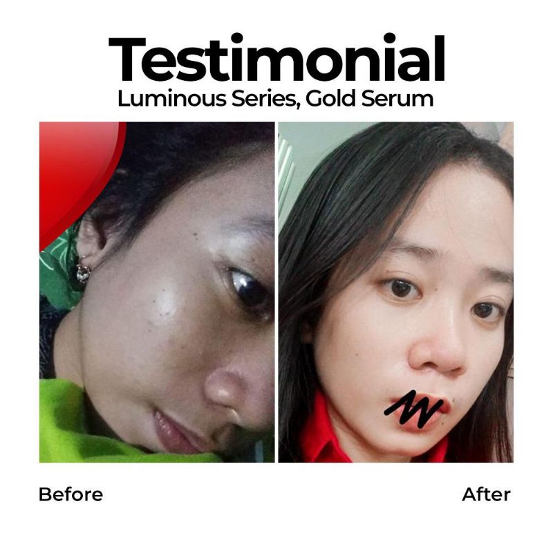 MS Glow Paket Wajah Luminous Series / Perawatan Wajah Bekas Noda Jerawat Ms Glow-8