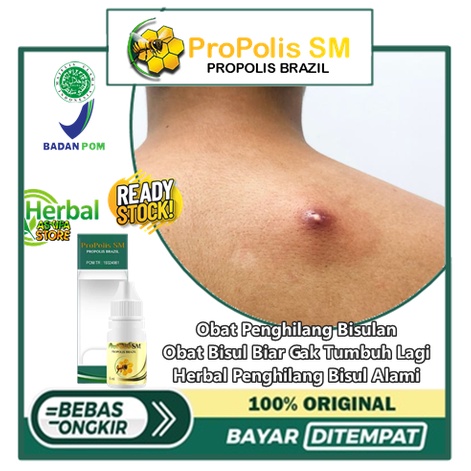 Obat Penghilang Bisulan, Obat Bisul Biar Gak Tumbuh Lagi, Herbal Penghilang Bisul Alami, Obat Oles B