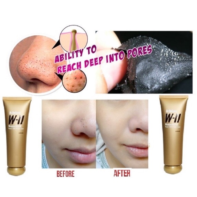 WII Acbegone Pell of Mask (masker angkat komedo & mencerahkan wajah