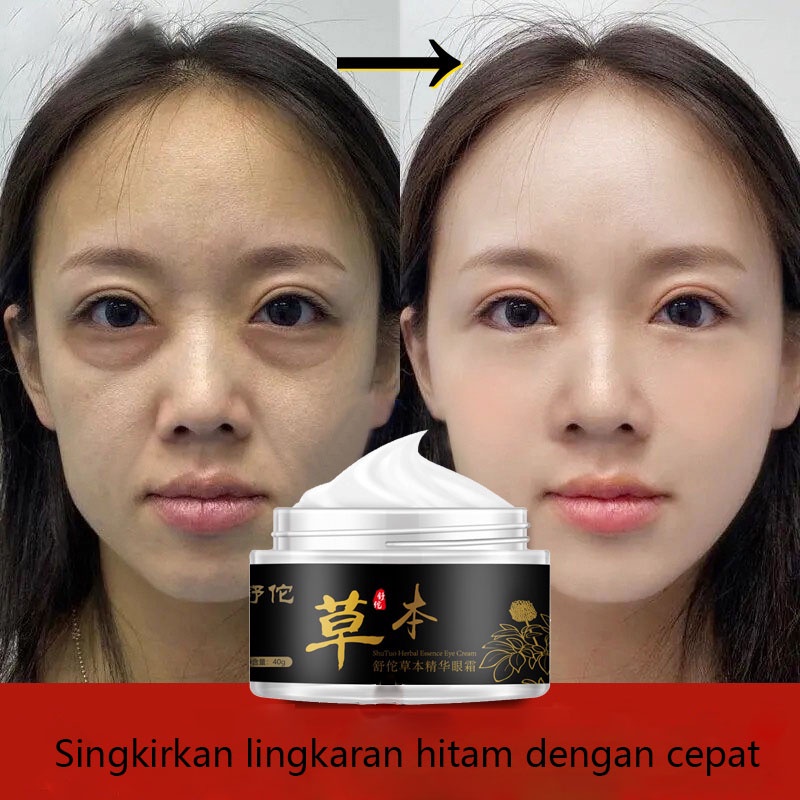 serum mata cream mata panda dan kantung mata Krim mata 40g Ekstrak Sari Herbal Shutuo Untuk Menghilangkan Kerutan Mata Dan Menyehatkan Kulit