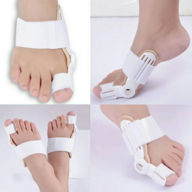 hallux valgus . pemisah jari jempol. bunion pad