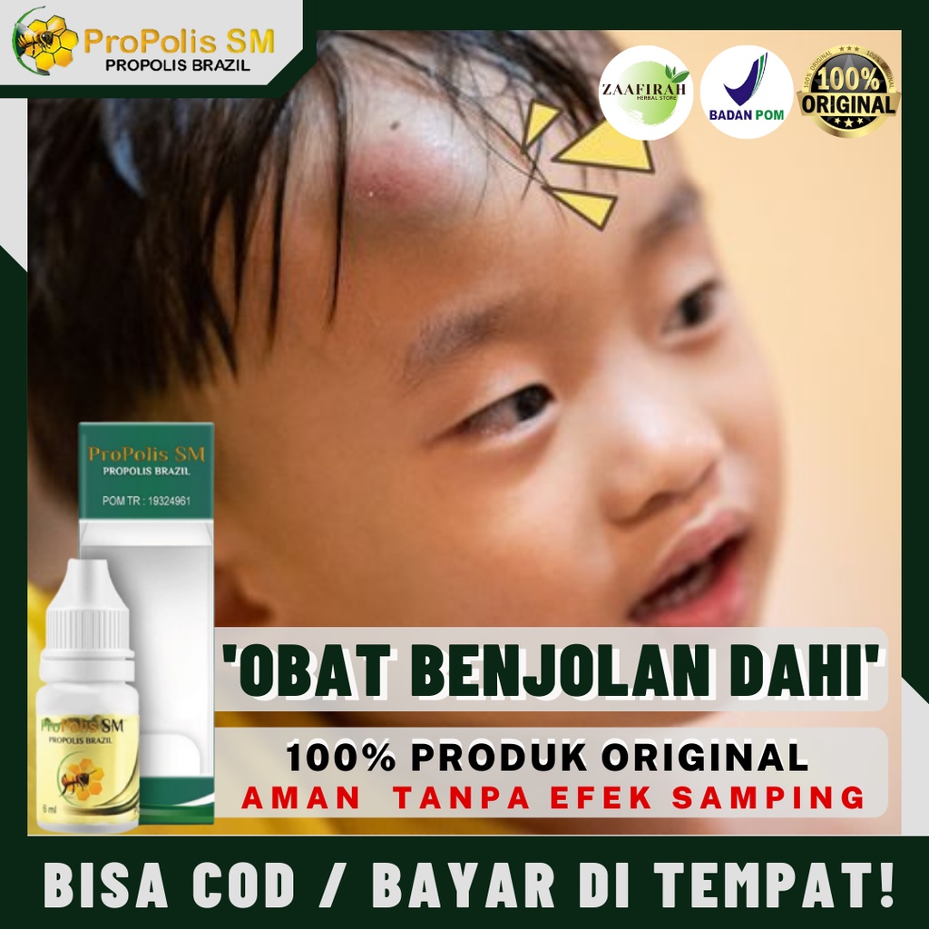 Obat Benjolan Di Dahi - Penghilang Benjolan Di Dahi - Benjolan Di Kepala - Benjolan Di Jidat - Penge