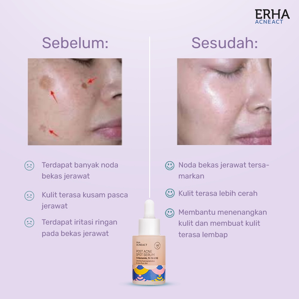 ERHA Acneact Post Acne Serum 30ml - Serum Untuk Menyamarkan Bekas Jerawat-1