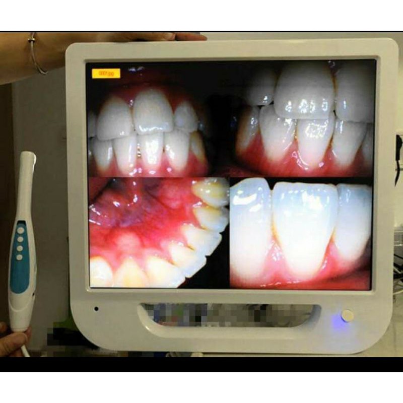 1 set Camera intra oral dengan LCD lengkap