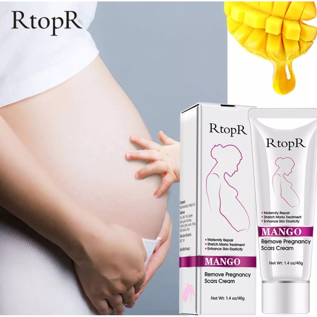 [Ori100%]RtopR Mango Pregnancy Scars Cream Maternity Repair Firming Enhance Skin Elasticity Stretch Marks Treatment Tubuh Postpartum Stretch Mark Perbaikan Krim Anti-Aging Kulit 40g