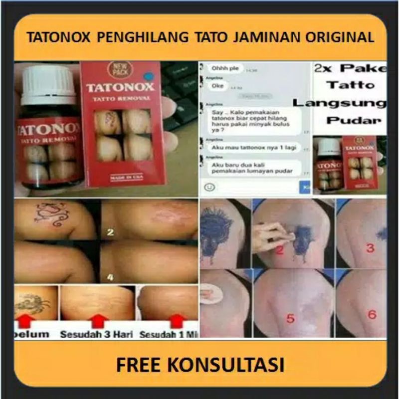 Tatonox Tattonox Ori Original Tatonok Obat Penghilang Penghapus Tato Tatto Tatonox Permanen Asli