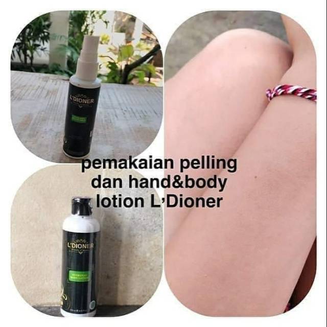 L 'Dioner