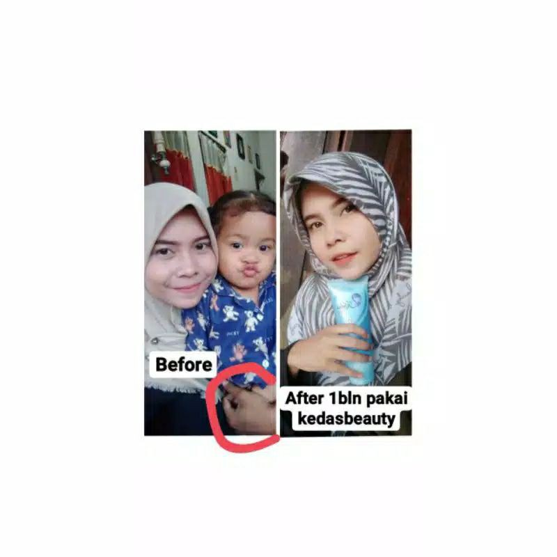 KEDAS BEAUTY BODY SERUM ORIGINAL BPOM (READY)-7