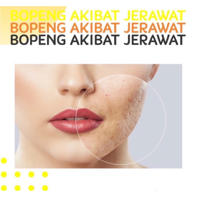 Satuan Acne Venusglow Clinic Satuan Venus glow