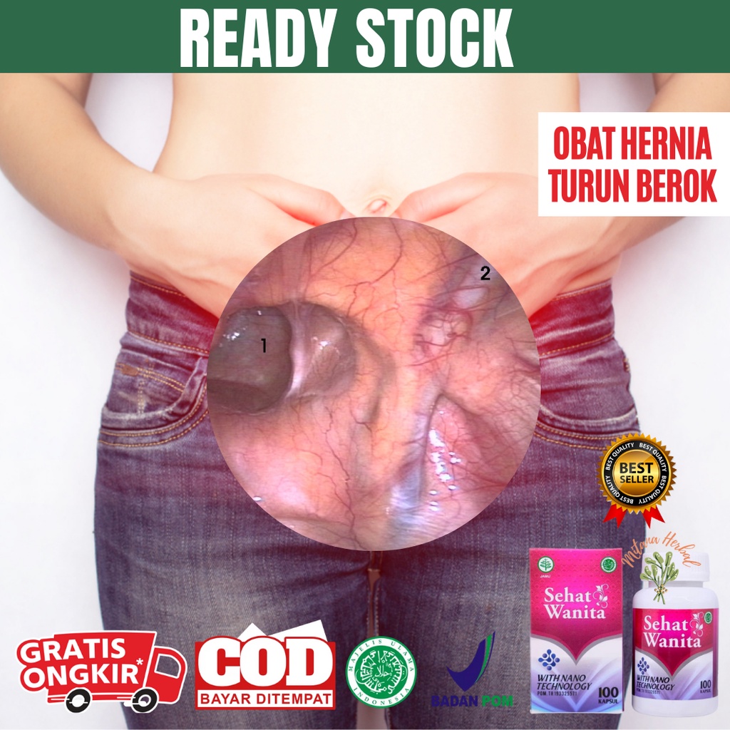 Obat Hernia Obat Turun Berok Wanita, Turun Peranakan, Turun Berok Bengkak, Turun Rahim/ Sehat Wanita