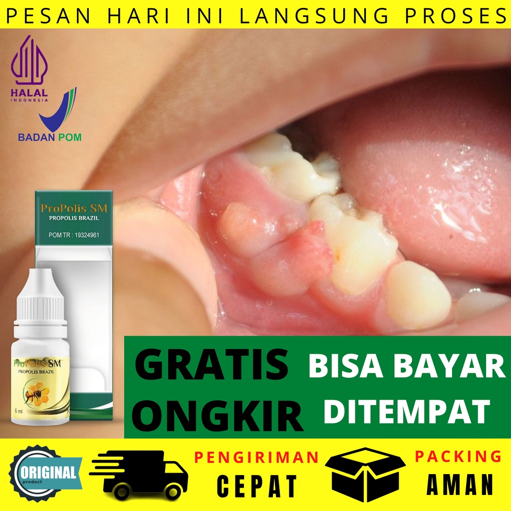 Obat Gusi Bengkak - Sakit Gigi