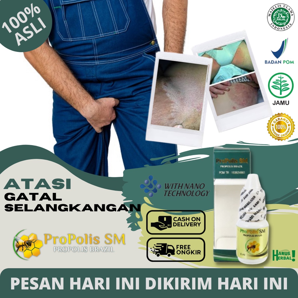Obat Alami Gatal Selangkangan, Jamur Selangkangan, Selangkangan Lecet, Infeksi, Penghilang Gatal Sel