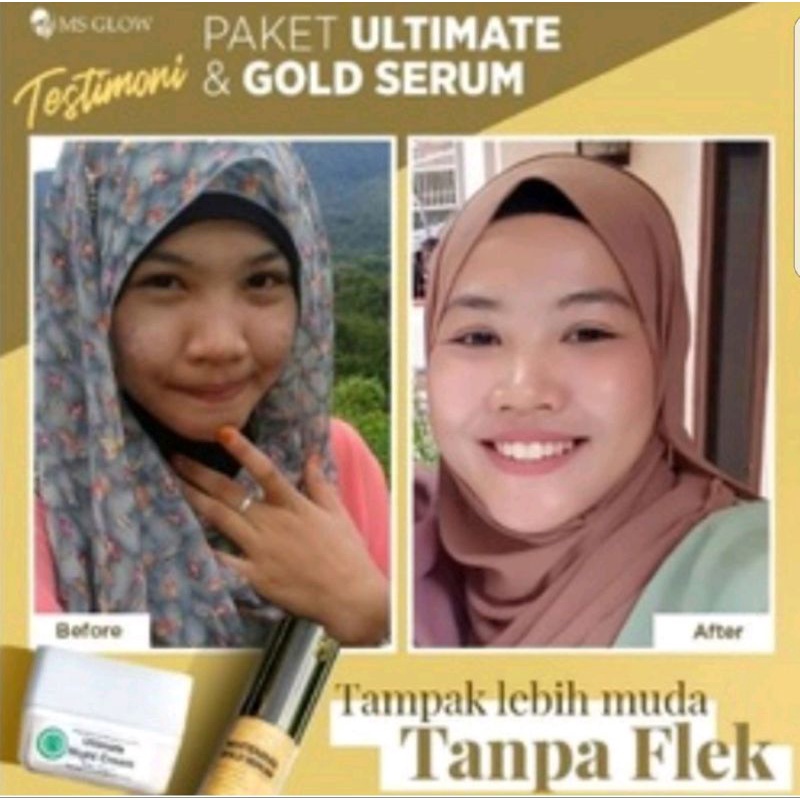 Serum Gold+cream ultimate,luminous,whitening,acne MS GLOW.