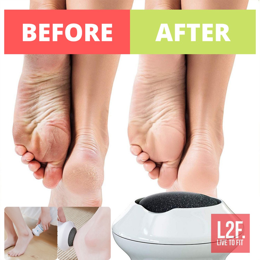 Alat Penghalus Perawatan Pembersih Kulit Tumit Kaki Kasar Personal Pedi Foot Grinder Find Back